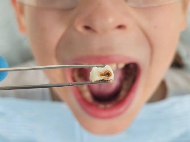 Best Broken or Cracked Tooth Emergency Dentist in Battlefield, MO
